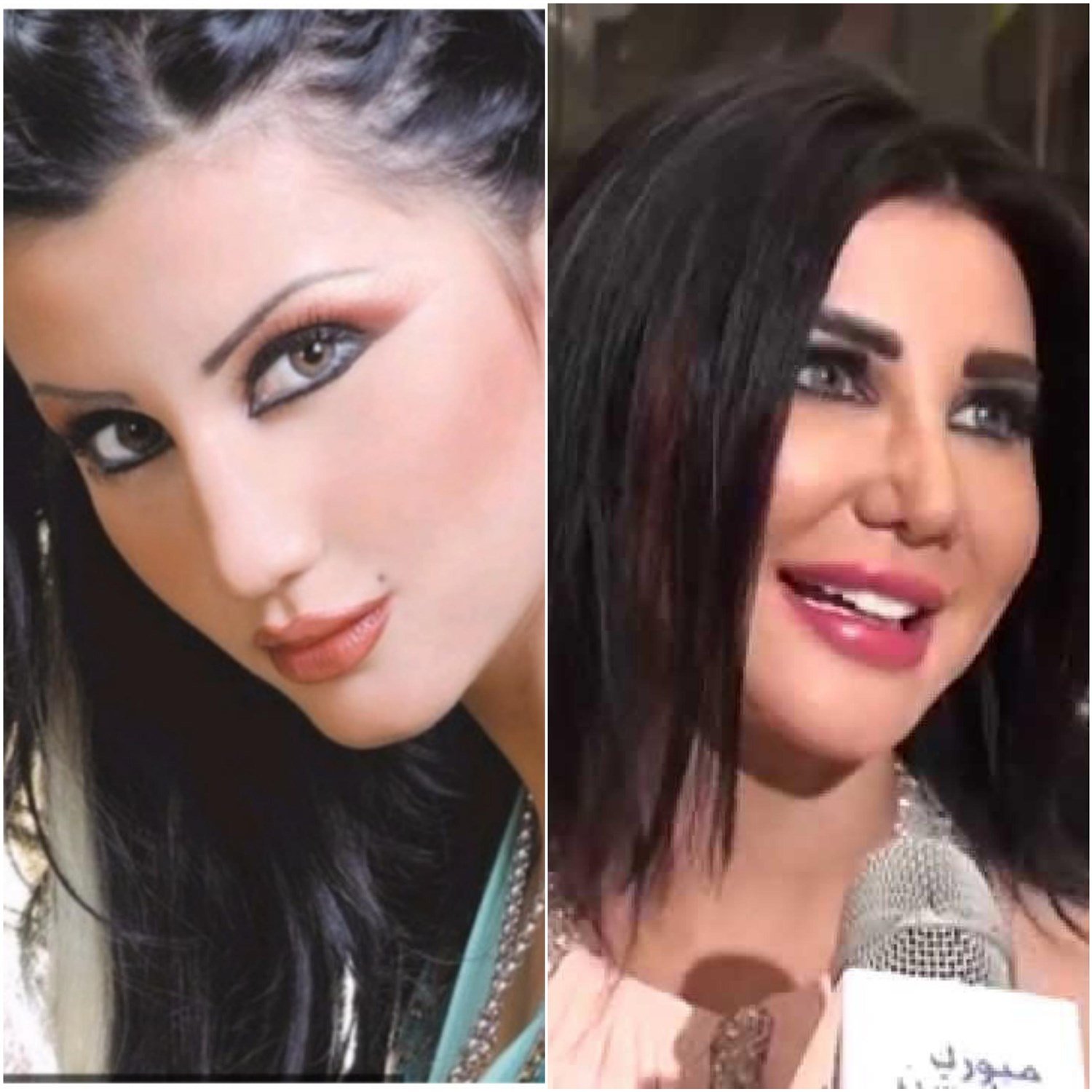 نجمات سوريا قبل وبعد التجميل تغيّرت ملامحهنّ بشكل بسيط ومنهنّ بشكل أكبر