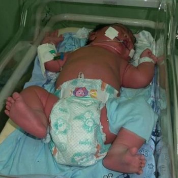 ولادة طفل عملاق في البرازيل